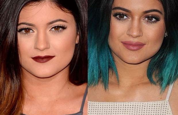 kylie-jenners-antes-y-deoskkues-619x400